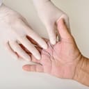 doctor treating a patient's hand, close-up of the hand with stitches visible on the index and middle fingers