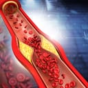 Digital representation of plaque building up inside a blood vessel