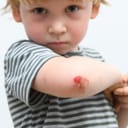 Boy with a skinned elbow