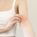 Woman scratching the eczema on her left elbow pit