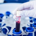 Close-up of a hand holding a tube containing blood for platelet-rich plasma preparation.