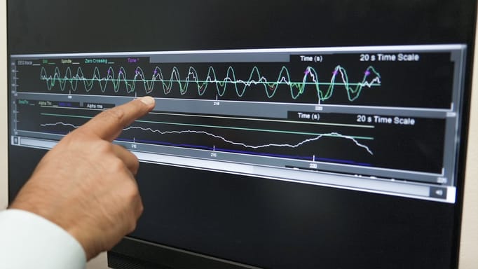 Dr. Roneil Malkani points to a recording of pink noise being played at brief intervals to enhance slow brain waves during deep sleep at the Center for Circadian & Sleep Medicine at Northwestern Medicine in Chicago