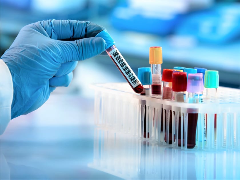 Blood Test Can Detect 50 Types of Cancer | Engoo Daily News