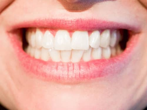 Drug Helps Teeth Repair Themselves Engoo Daily News